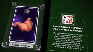 Gastric volvulus [upl. by Haidej]