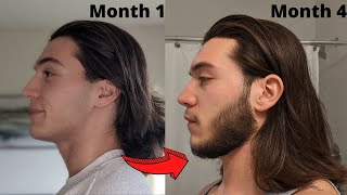 4 MONTH Minoxidil Beard Transformation  Beard Growth Results [upl. by Phi]