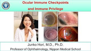 Ocular Immune Checkpoints and Immune Privilege [upl. by Aicnilav]