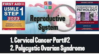 USMLE step 1Cervical carcinoma PCOS from First AidReproductive PathologyUrduHindi [upl. by Eneleuqcaj138]