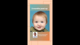 National Cleft and Craniofacial Awareness and Prevention Month [upl. by Acinaj]