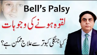 Bells Palsy  Laqwa ka Ilaj  Facial Paralysis Causes amp Treatment By Dr Khalid Jamil [upl. by Anderegg]