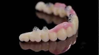 K Dental LabZirkonzahn PrettauImplant screwretained bridge1mov [upl. by Yssenhguahs]