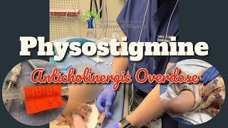 Physostigmine for Severe Doxylamine Overdose [upl. by Yuri476]