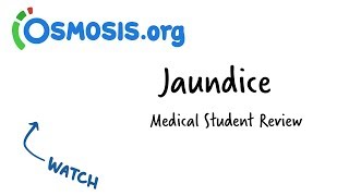 Jaundice  Clinical Presentation [upl. by Prudhoe]