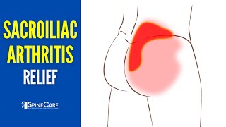 How to Instantly Relieve Arthritic Sacroiliac Joint Pain [upl. by Kresic]