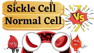 Sickle Cell Anemia  Animation  MLT TUTELAGE [upl. by Amehr516]