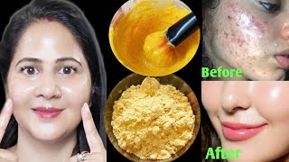 सिर्फ 3 Days मैंSmooth Tight Glass SkinNo Pores No रिंकल्स पाएं हीरे जैसी चमक👌 [upl. by Atcele801]