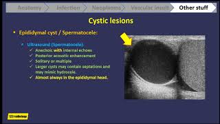 Scrotal ultrasound part 2 [upl. by Kean]