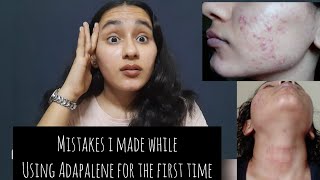 My Adapalene mistakes Using too much product  Irritationrednessdry skin Khushi Mahla [upl. by Gentille]