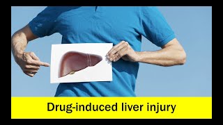 DrugInduced Liver Injury Intrinsic and Idiosyncratic [upl. by Miculek]