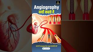 What is Angiography in Hindi angiography radiographerexam testpaperliveparamedicalclasses [upl. by Otxilac]