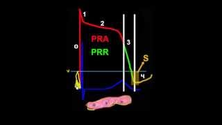 CURSO DE ELECTROCARDIOGRAFIA 46  EXTRASÍSTOLES [upl. by Luben]