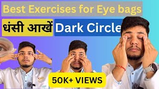 How to get rid of eye bags  Exercises for Eye bags and Dark circles [upl. by Holmun840]