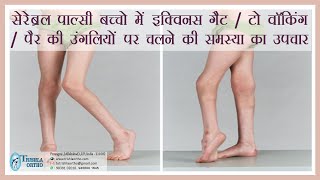 Treatment of Equinus gait toe walking walking on toes in cerebral palsy treatment at Trishla [upl. by Lette496]