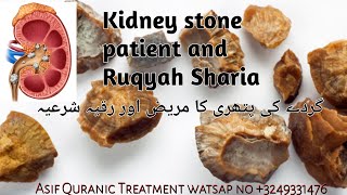 Ruqyah Se Pathri ka ilajQuran RecitationRuqyah IlajTreatment of gallstonesAsif Quranic Treatment [upl. by Ataner]