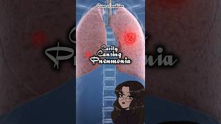 CavityCausing Pneumonia causativeorganisms shorts medicalshorts [upl. by Grane]