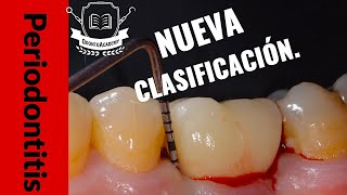 NUEVA CLASIFICACIÓN PERIODONTAL  CÓMO SE CLASIFICA LA PERIODONTITIS Actualización periodoncia [upl. by Engvall]