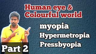 Defects of eye  part 2 NCERT classes in telugu [upl. by Huberto]