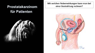 Prostatakarzinom für Patienten  Nebenwirkungen der Bestrahlung  Prof Hilke Vorwerk [upl. by Eelrehpotsirhc]