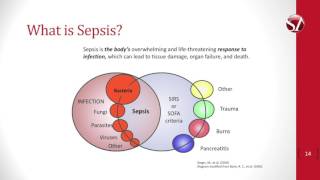 Nurses Suspect Sepsis Educational Video [upl. by Eirrab]