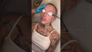 Swissa MedSpa  Tattoo Removal with ★ Siiickbrain ★ [upl. by Evyn]