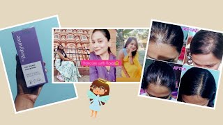 BE BODYWISE HAIR GROWTH CONCENTRATE  HAIR FALL  NON SPONSORED REVIEW [upl. by Yniffit]