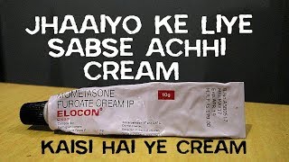 Elocon Cream Honest Review After Using 20 Days  Best Cream For Melasma In India [upl. by Yarezed]