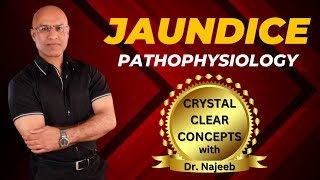 Pathophysiology Of Jaundice  Dr Najeeb Lectures [upl. by Alidis]