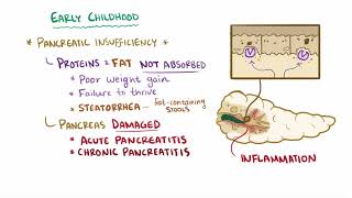 Cystic fibrosis causes symptoms diagnosis treatment amp pathology [upl. by Asli]