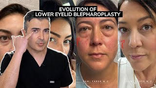 Evolution of Lower Eyelid Blepharoplasty  Dr Parsa Explains Trifecta Lift [upl. by Tam]