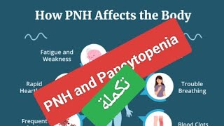 Male patient with pancytopenia التكمله [upl. by Thaine]