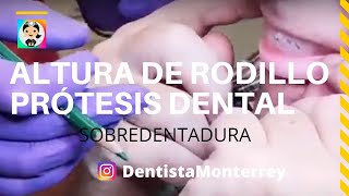 Cómo se Ajusta❓ RODILLO👅 SOBRE DENTADURA [upl. by Evetta]