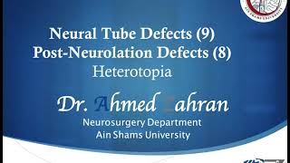 Neural Tube Defects 9 PostNeurolation Defects 8 Heterotopia [upl. by Ilellan86]