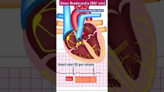 Sinus Bradycardia l Heart conduction system l लो हार्ट बीट lecg echo shorts [upl. by Liggitt]