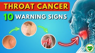 Spotting Throat Cancer Early 10 Warning Signs You Should Know  Throat Cancer Symptoms [upl. by Torr528]