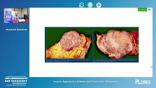 pancreatic surgery workshop Damanhour 2023 part 2 [upl. by Winebaum]