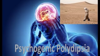 Psychogenic Polydipsia Water Intoxification [upl. by Vange]