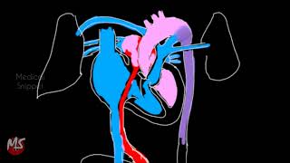 Fetal Circulation  Anatomy  Made easy  3 minutes [upl. by Eustatius462]