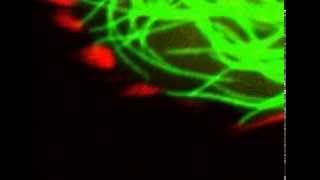 Microtubules poking focal adhesions [upl. by Hachman734]