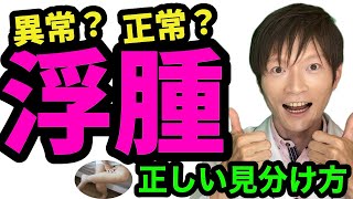 浮腫（むくみ）の正常異常の見分け方〜原因〜対処法〜注意点について、慢性腎臓病も含めて腎臓内科専門医が解説。 [upl. by Adnilam298]