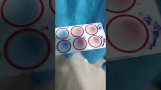 Agglutination test mixing procedure [upl. by Tsiuqram708]