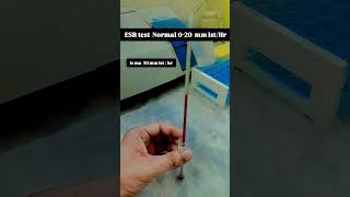 ESR test Normal in or bada hua 😱😱motivation viralvideo youtube me lab exammotivation [upl. by Sonitnatsnok]