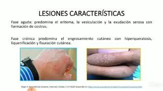 Dermatosis Reaccionales [upl. by Teena183]