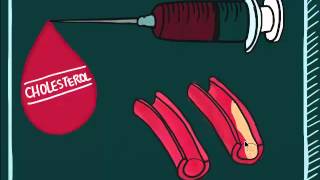 Understanding Blood Test Video 1 Lipid Profile and Hemoglobin A1C [upl. by Ennaharas68]