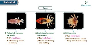 Pediculosis  Dermatology Lectures [upl. by Redvers857]