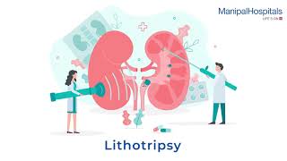 Understanding Lithotripsy A Guide to PreProcedure and PostProcedure  Manipal Hospitals India [upl. by Ziul]