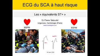 ECG du syndrome coronaire aigu Les équivalents ST à haut risque P Taboulet [upl. by Derman53]