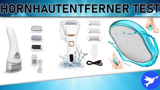 ᐅ Hornhautentferner Test 2023  Die besten Hornhautentferner vorgestellt [upl. by Eelydnarb771]