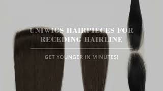 Best Solutions to Receding Hairlines Stay tuned [upl. by Sharline679]